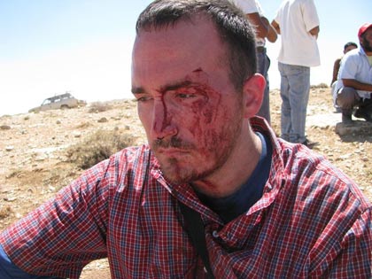Un militant de la paix américain attaqué par des enfants colons israéliens près d'Hébron