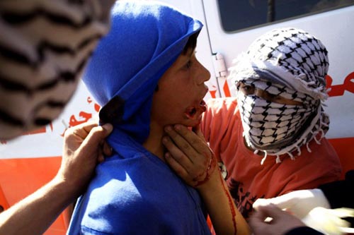 Nabi Saleh : les soldats israéliens blessent un jeune palestinien au visage et une militante française à la jambe