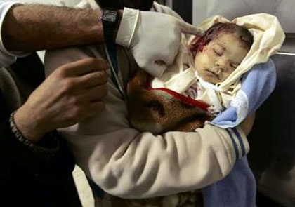 Le siège israélien entraîne de plus en plus d'anémie chez les nouveaux-nés de Gaza