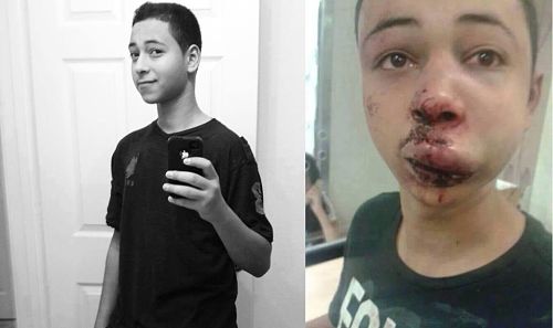 Vidéos : un jeune Palestinien sauvagement battu par la police israélienne à Shufat où a été enlevé l'adolescent assassiné