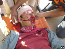'Israël' classe l'enquête sur un manifestant américain blessé par sa police