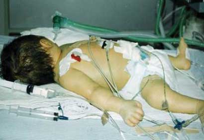 Gaza : une délégation médicale américaine soigne plusieurs dizaines d’enfants
