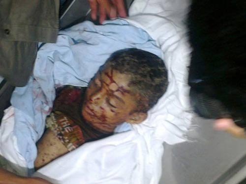 Depuis jeudi, 5 morts, dont un enfant de 6 ans, de nombreux blessés dans des attaques sionistes sur Gaza