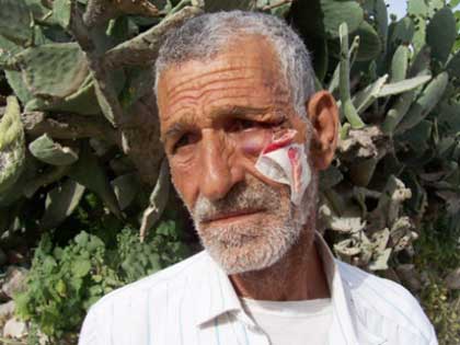 25 colons israéliens attaquent un fermier palestinien près d'Hébron