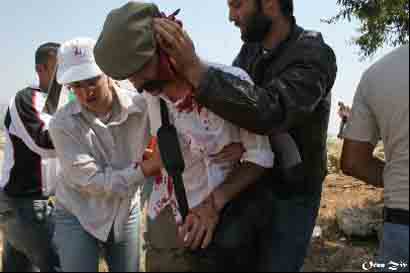 Bil'in : Nombreux blessés lors de la manifestation d'aujourd'hui : deux internationaux touchés à la tête par des balles en caoutchouc